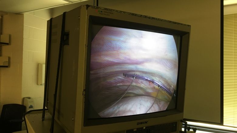 View from fiber-optic camera inserted into chest