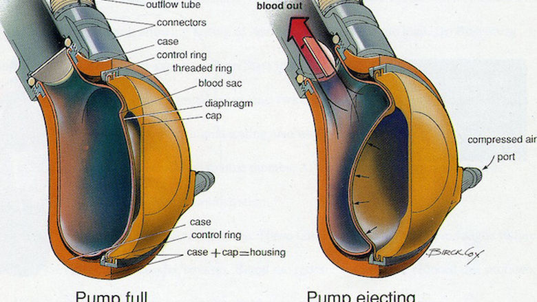 schematic of heart pump